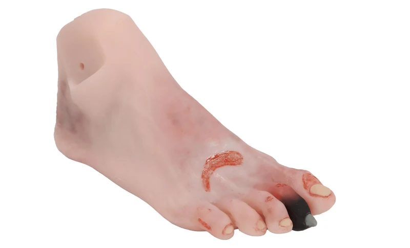 Wundenfuß mit diabetischem Fußsyndrom, für Puppe