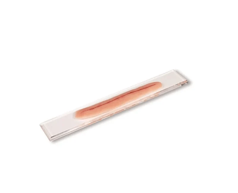 OP-Wunde 22 cm