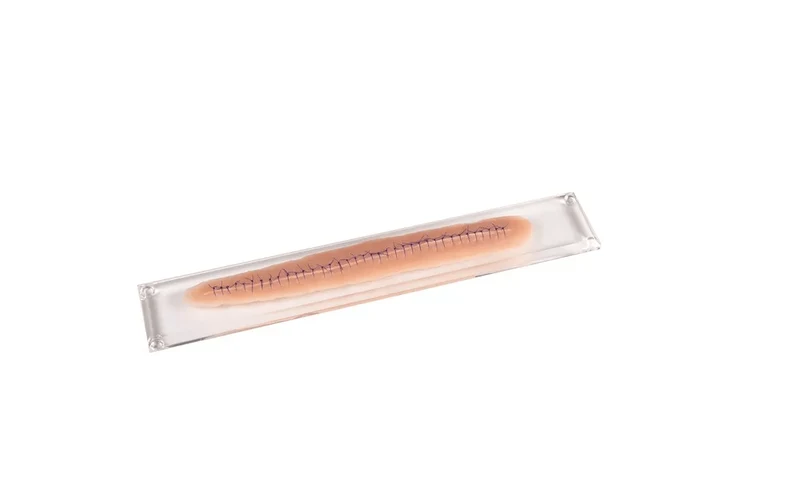 OP-Wunde 22 cm
