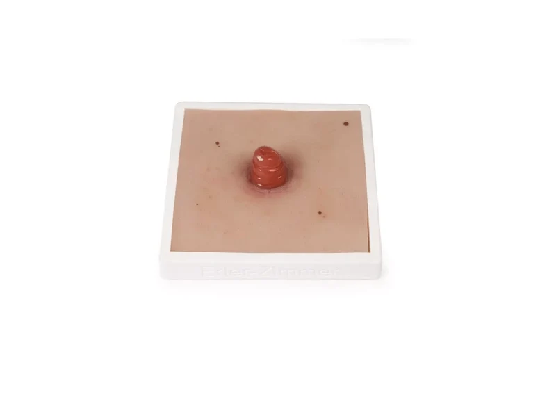 Wundmoulage Ileostoma, inkl. Stativ