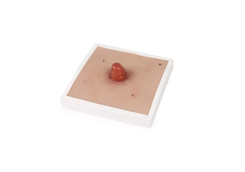 Wundmoulage Ileostoma, inkl. Stativ