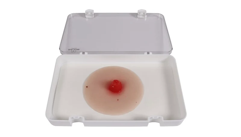 Wundmoulage Ileostoma, selbsthaftend