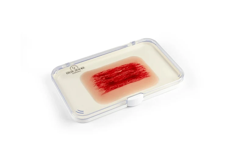 Wundmoulage Schürfwunde