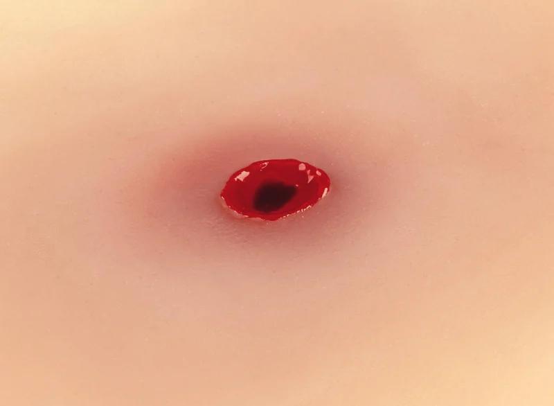 Wundmoulage Einschußwunde