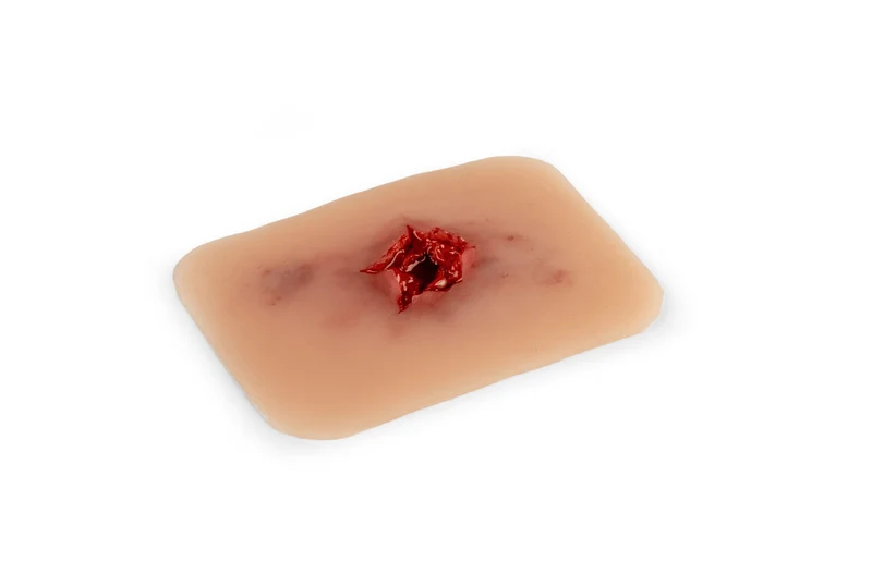Wundmoulage Schuß Austrittswunde