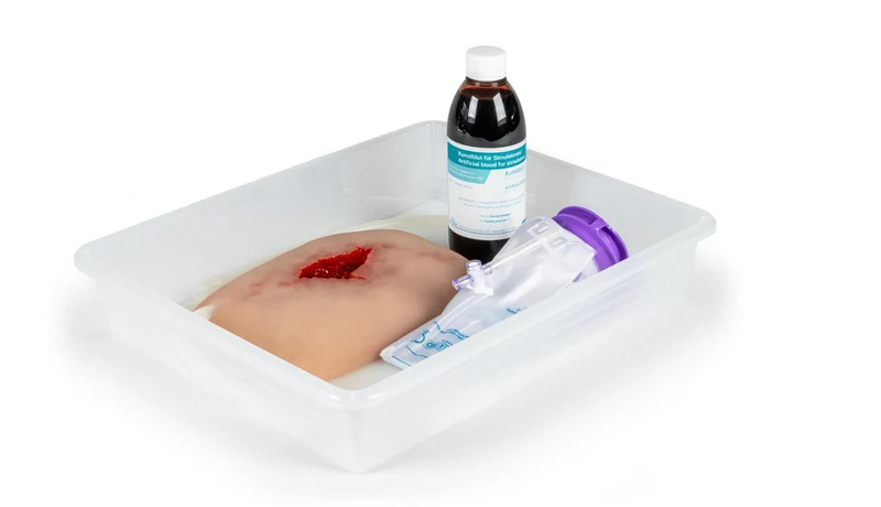 Wundmoulage wound packing