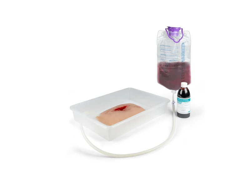 Wundmoulage wound packing