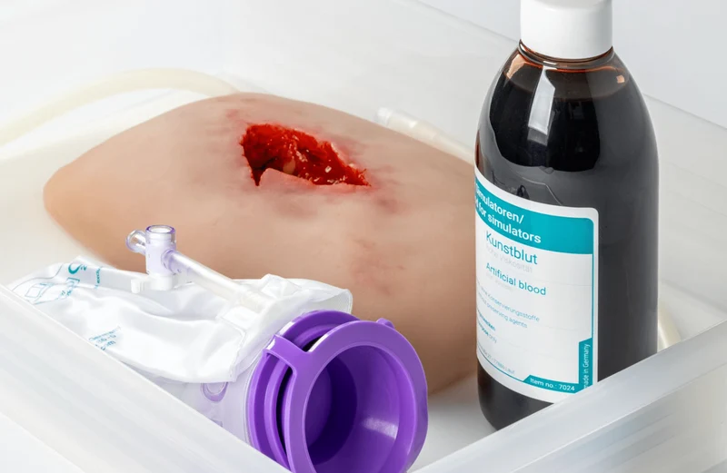Wundmoulage wound packing