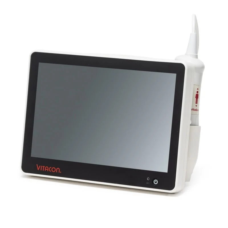 Vitascan eVue Blasenscanner