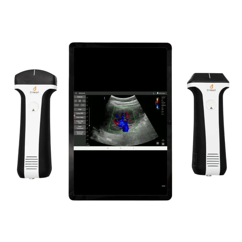 D-Heart handheld Ultraschallgerät Komplettset