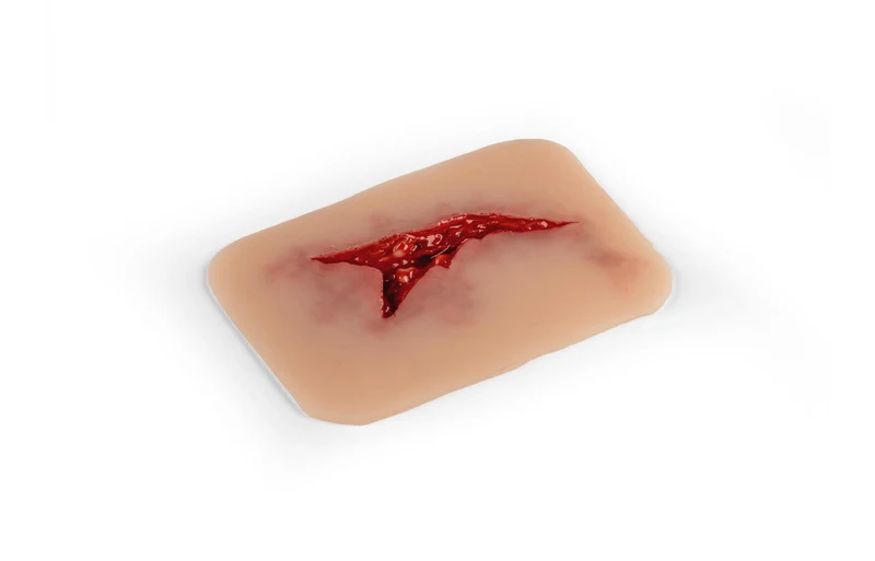Wundmoulage Risswunde