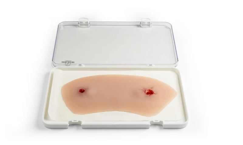 Wundmoulage Schuß Sprunggelenk