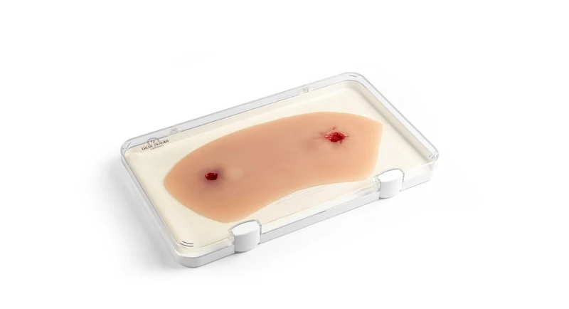 Wundmoulage Schuß Sprunggelenk