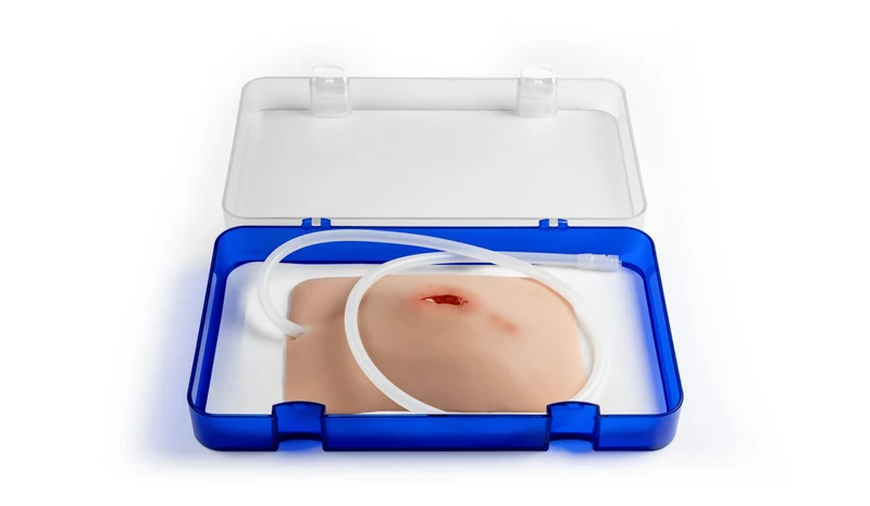 Wundmoulage Stich Leiste, Wound Packing