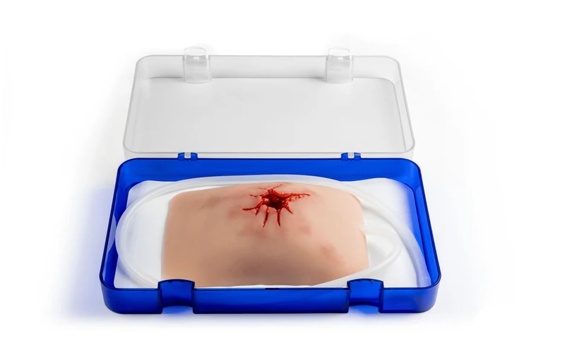 Wundmoulage Schuß Leiste, Wound Packing