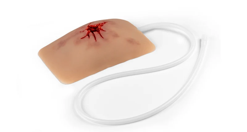 Wundmoulage Schuß Leiste, Wound Packing