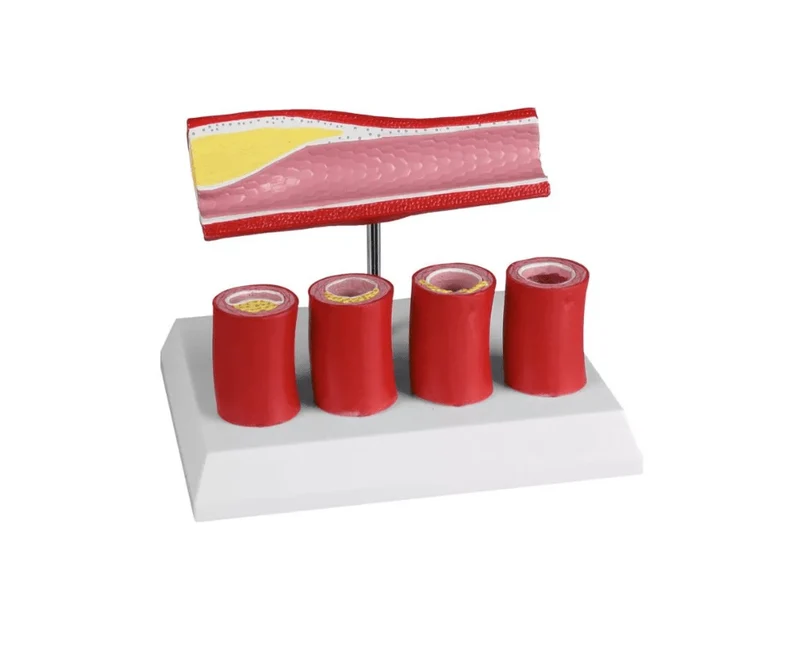 Arterie mit 4 Arterienschnitten