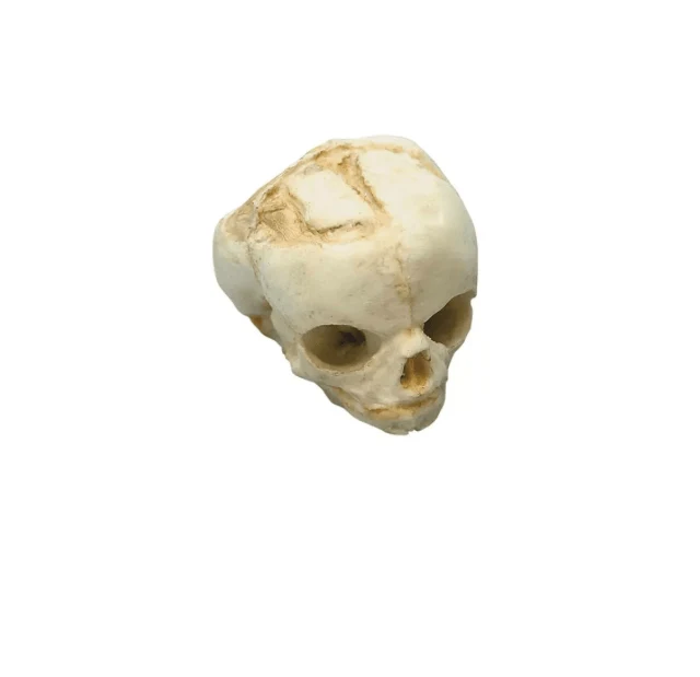 Fetusschädel, 17 Wochen