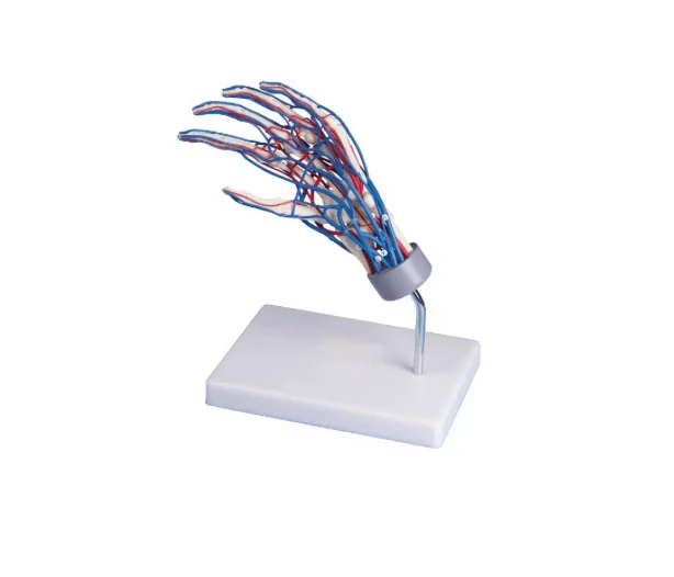 Gefäßhand