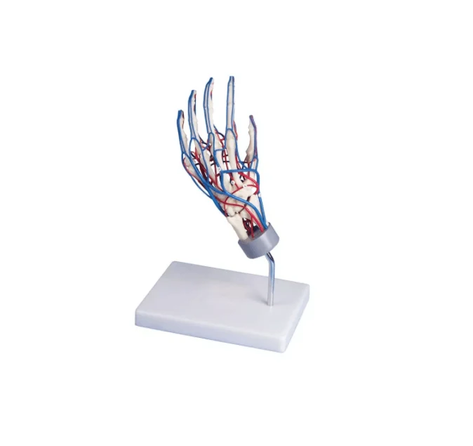 Gefäßhand