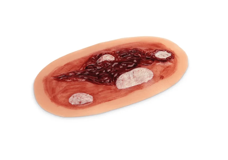 Krankenpflege-Moulagen-Kit