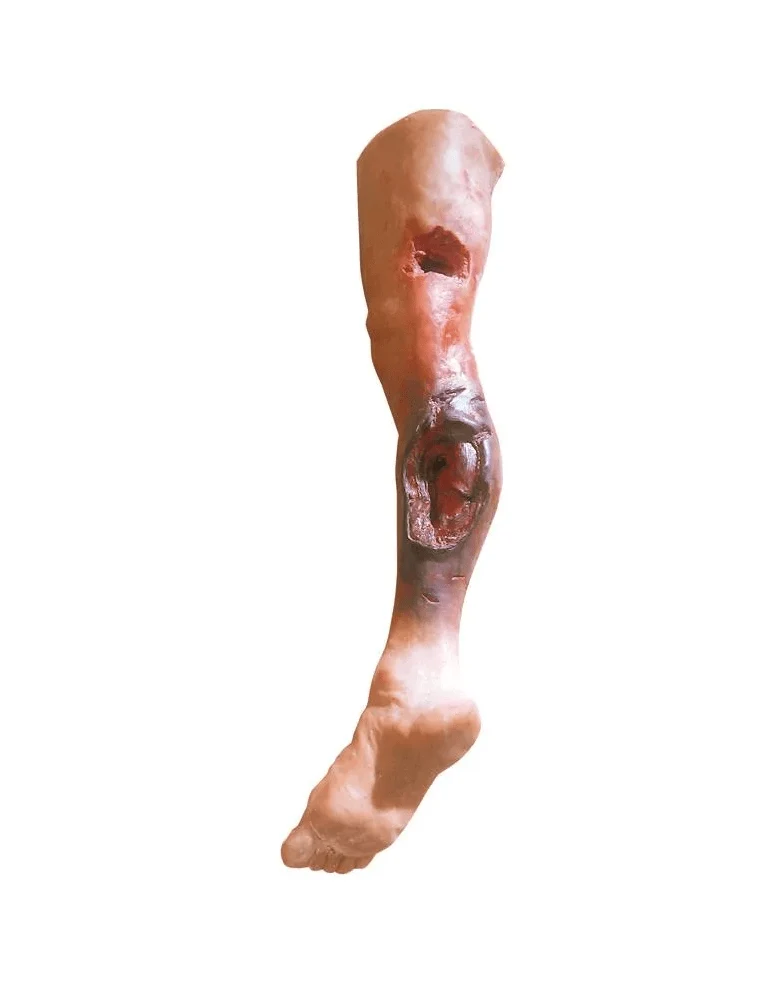 Notfallbein