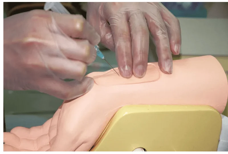 Handgelenk zur Arterienpunktion