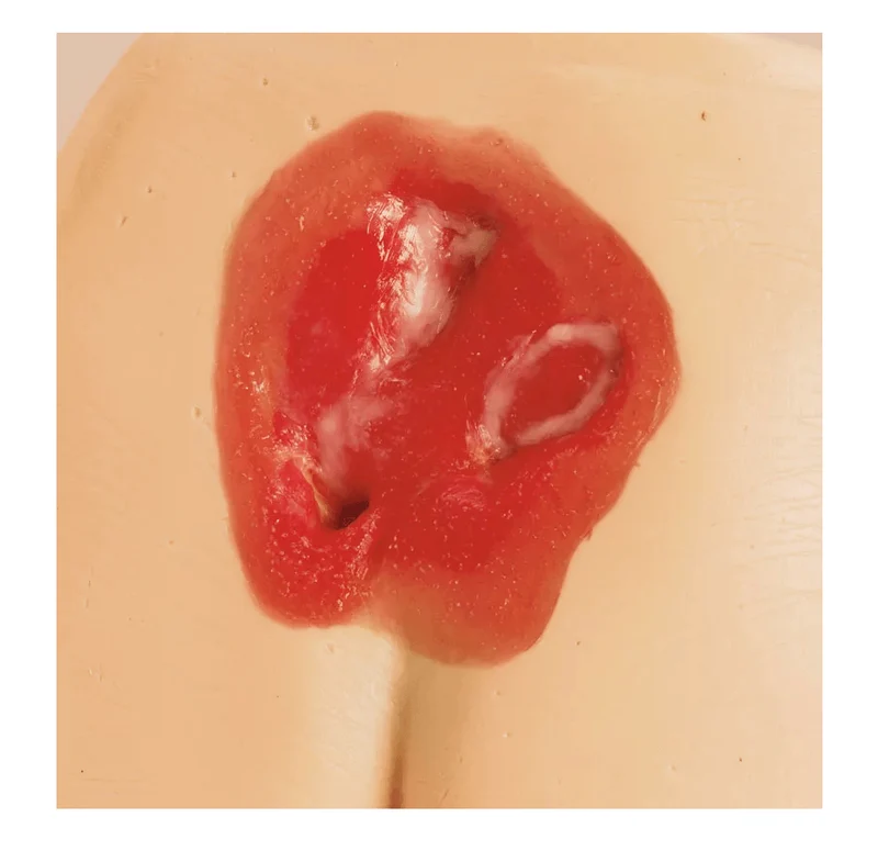 Druckgeschwür / Dekubitus Modelle