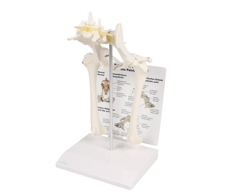Hundehüftgelenk Modell gesund & arthrotisch