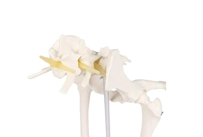 Hundehüftgelenk Modell gesund & arthrotisch