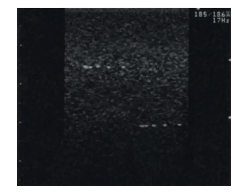Vielzweck-Ultraschallphantom für Qualitätssicherung