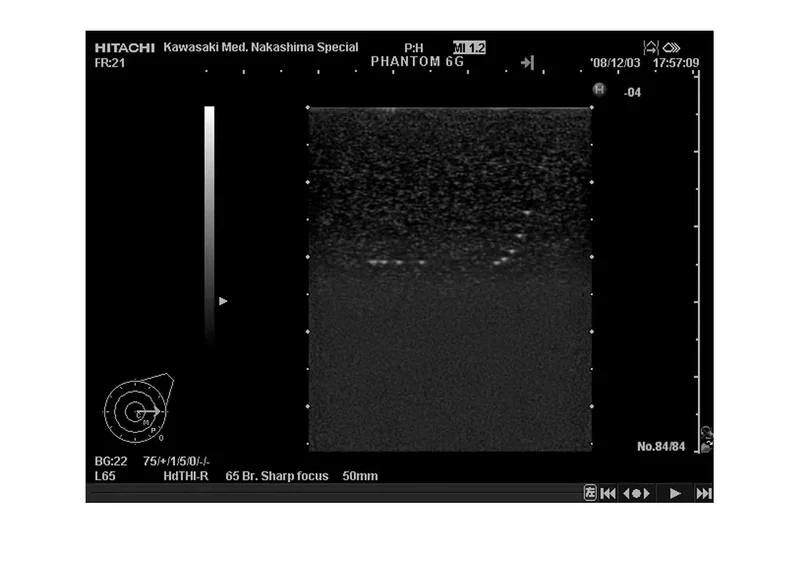 Brust-Phantom für Hochfrequenz-Sonografie