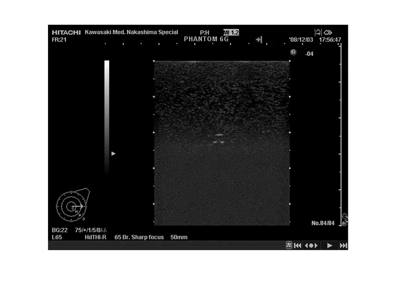 Brust-Phantom für Hochfrequenz-Sonografie