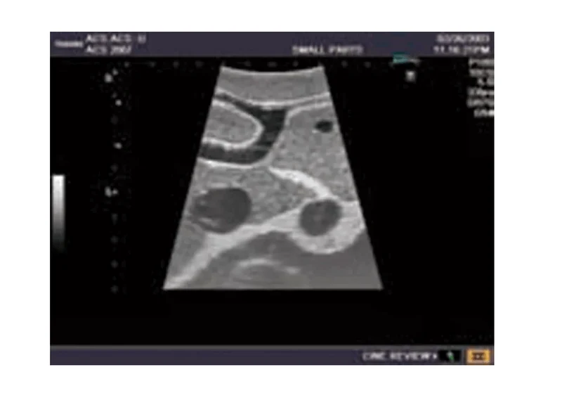 Abdomen-Ultraschallmodell für Sonografie-Training