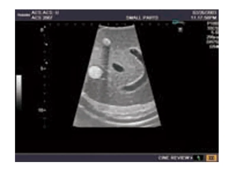 Abdomen-Ultraschallmodell für Sonografie-Training