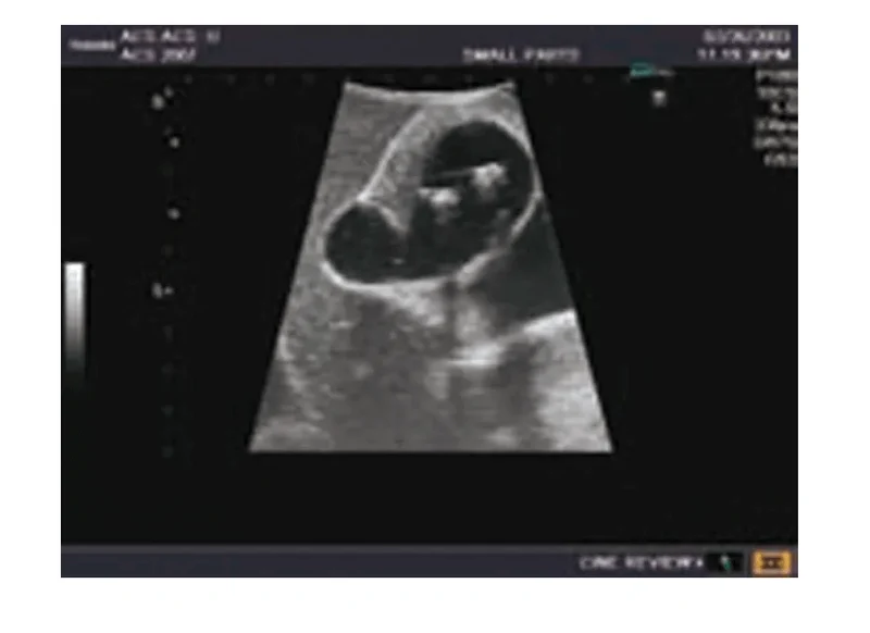 Abdomen-Ultraschallmodell für Sonografie-Training
