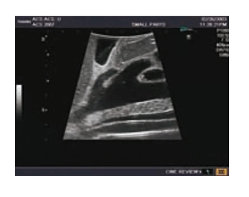 Abdomen-Ultraschallmodell für Sonografie-Training
