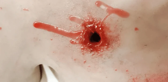 Trauma Training Torso