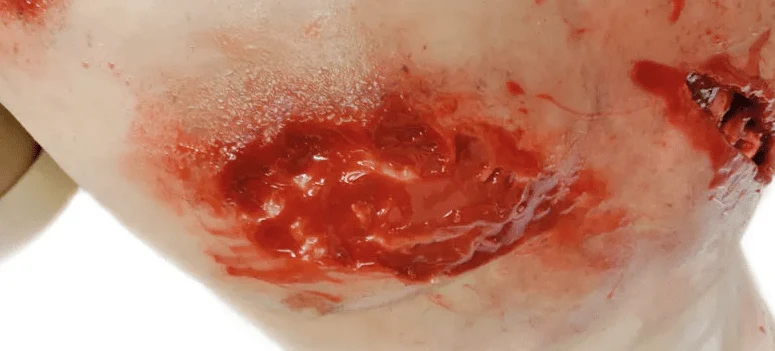 Trauma Training Torso