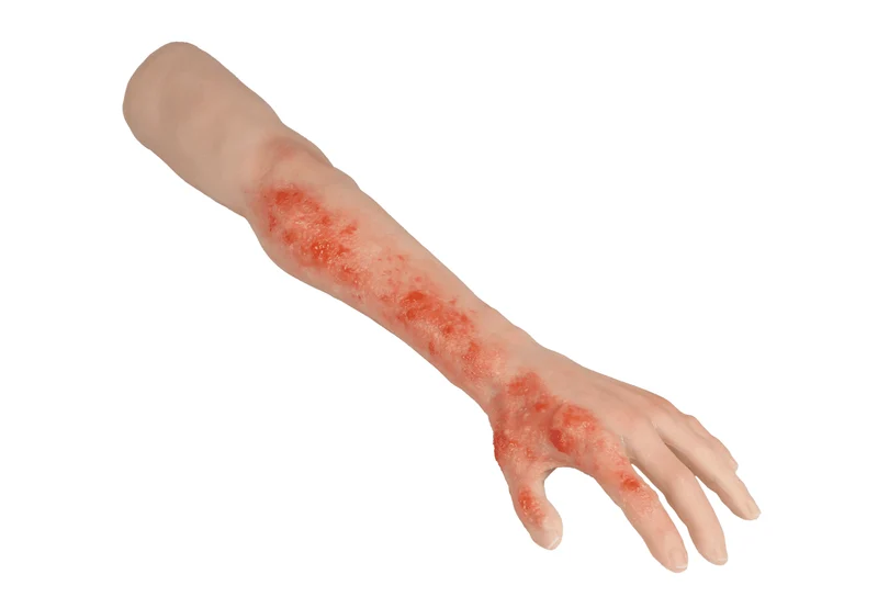 Arm mit Verbrennungen Task-Trainer