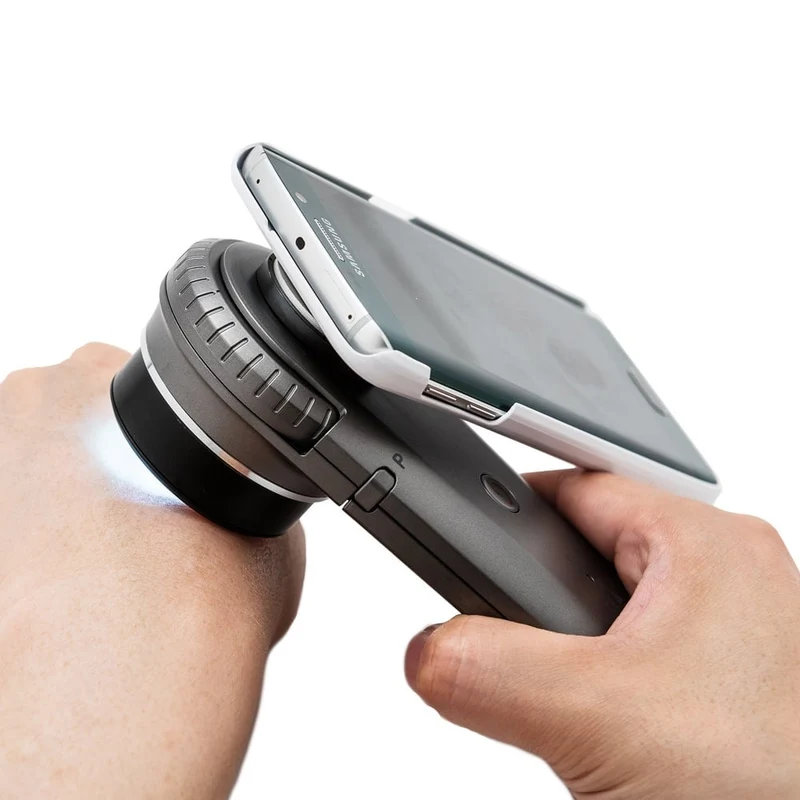DermoScan Smartphone-Adapter