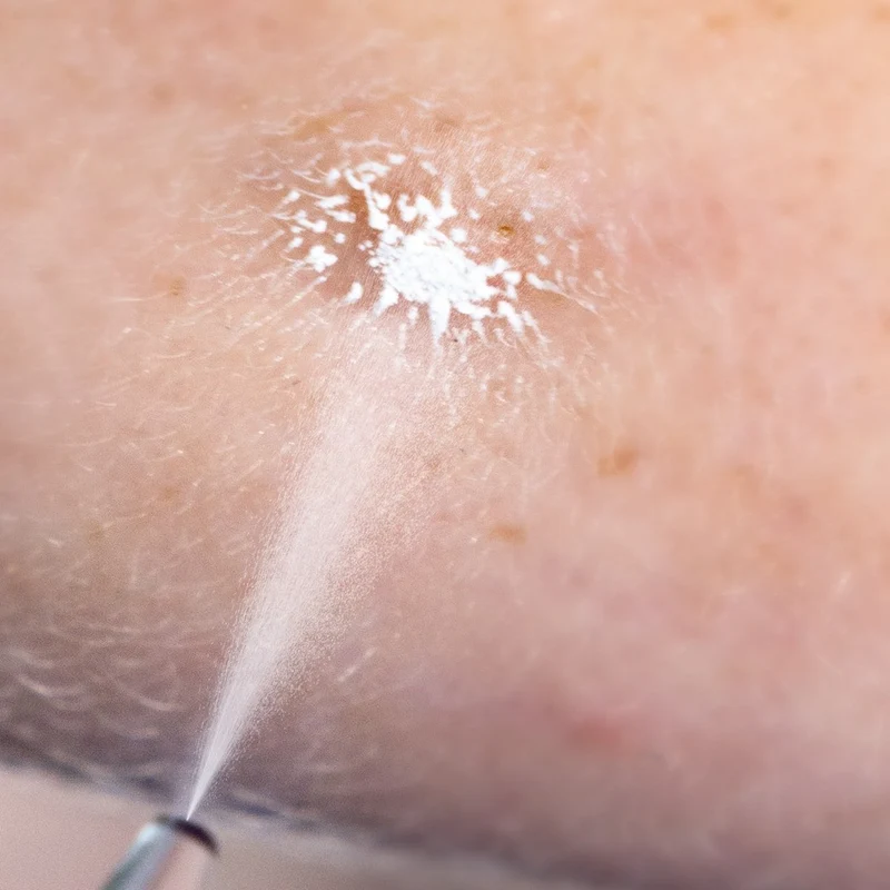 Cryoalfa SUPER