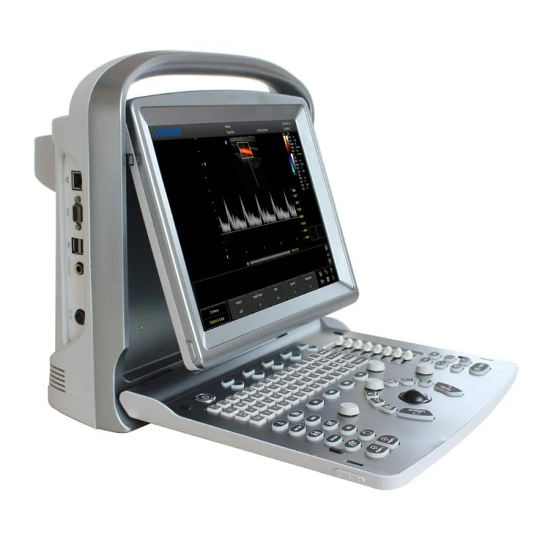 CHISON ECO5 Ultraschallgerät mit Farbdoppler