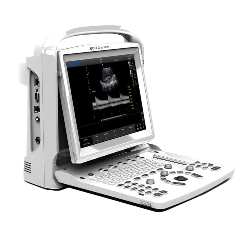 CHISON ECO3 Expert Ultraschallgerät