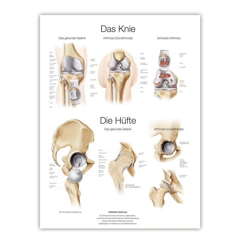 Lehrtafel Das Knie/ Die Hüfte