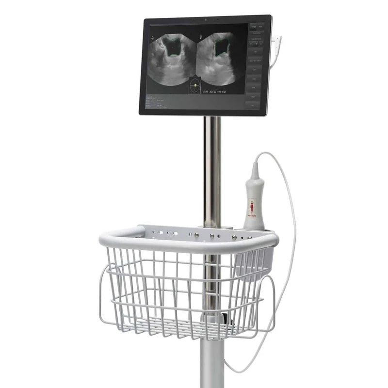 Vitascan LT Blasenscanner