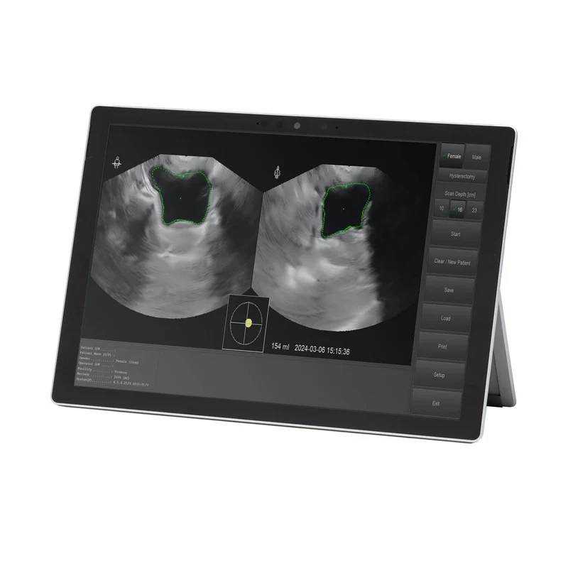 Vitascan LT Blasenscanner