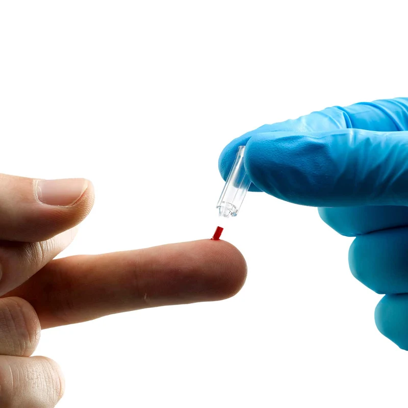 Quo-Test® HbA1c Testgerät