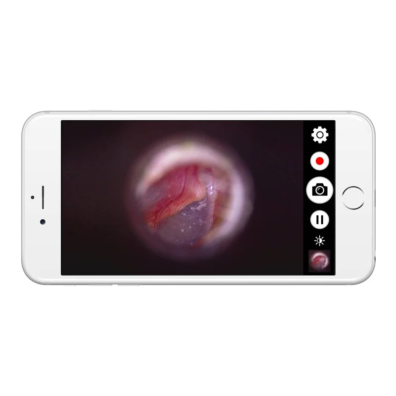 Firefly DE570 W-LAN HD Digital-Otoskop