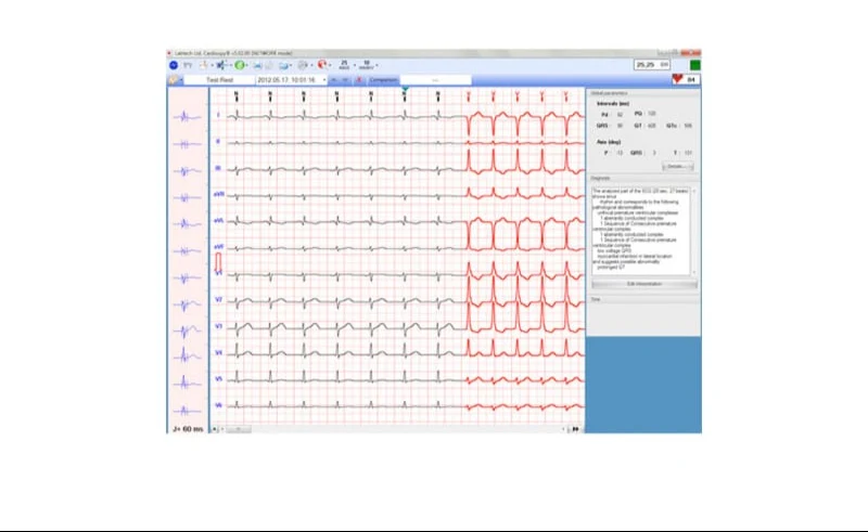 ECG-1000 EKG-Management Software für Biocare